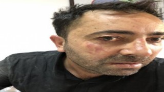 Iğdır eski Belediye Başkan yardımcısı Yunanistan sınırında gözaltına alındı